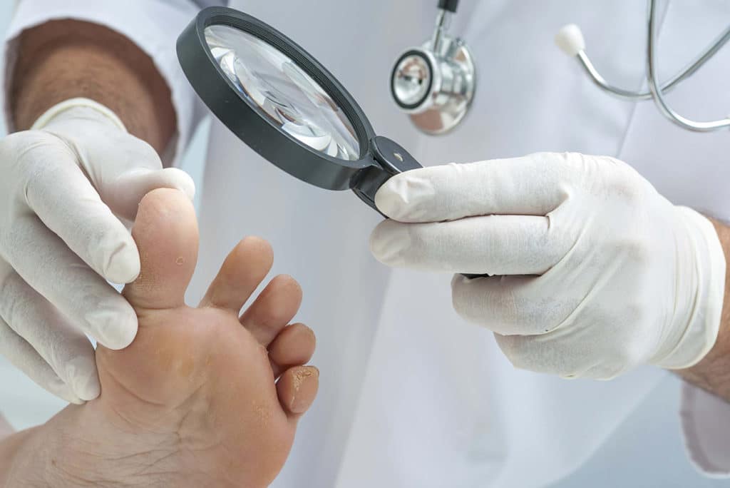 Восстановление ногтей после грибка на ногах