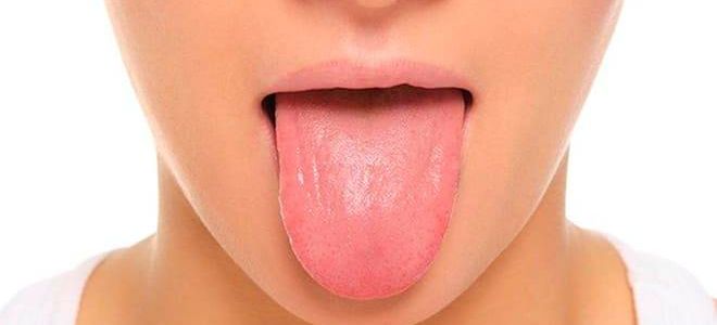 Глоссит: симптоматика, разновидности, лечение и профилактика воспаления языка